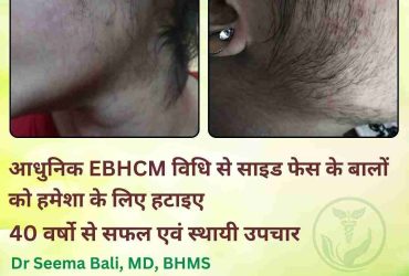 PERMANENT TREATMENT FOR UNWANTED HAIR VALEDA EBHCM